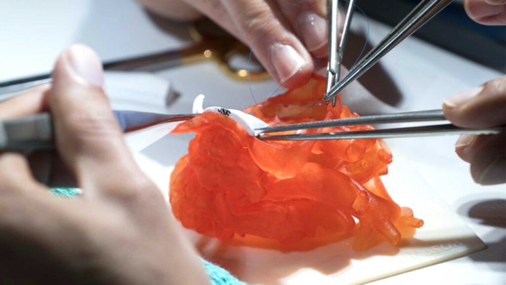 3D Printer Medical Capabilities