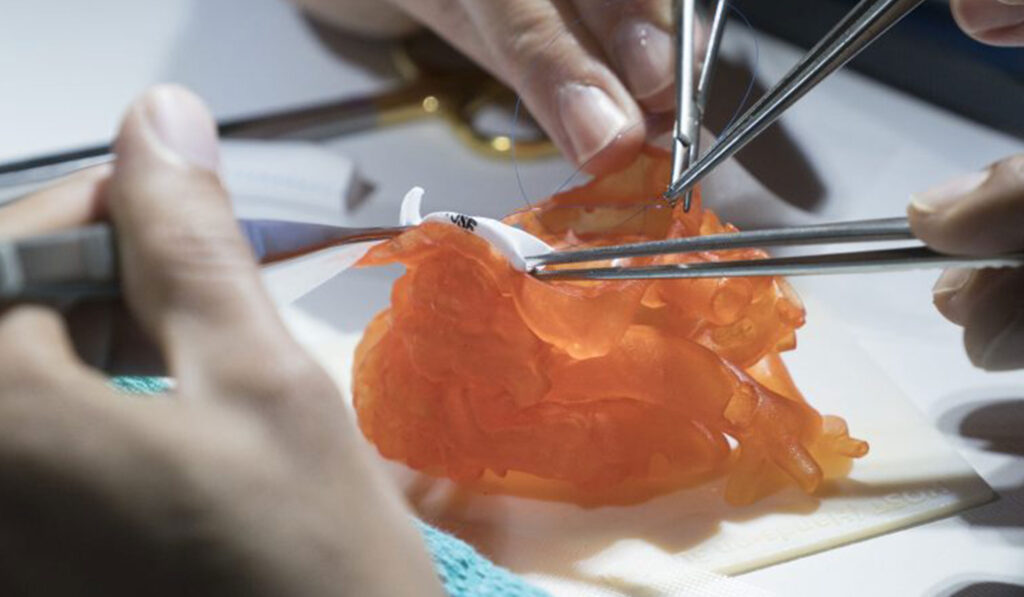 3D print precision anatomical Models