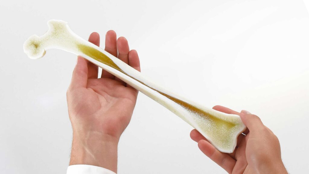 3D-printed-bone-model