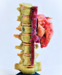 Anatomical new
